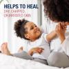 image:imageAquaphor Childrens Advanced Therapy Healing Ointment 41 Petrolatum Skin Protectant Ointment for Minor Wound Care Chapped or Cracked Skin and Lips 175 Oz Tube175 Ounce Tube
