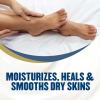 imageGold Bond Healing Foot Cream 4 oz Pack of 4 With Aloe Nourishes ampamp Softens For Healthier Looking Feet
