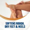 imageGold Bond Softening Foot Cream 4 oz With Shea Butter to Soften Rough ampamp Dry Feet
