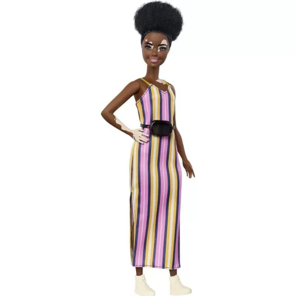 Barbie Fashionistas Doll 135 with Natural Curly Hair and Vitiligo Wearing Striped Dress and AccessoriesBarbie Fashionistas Doll 135 with Natural Curly Hair and Vitiligo Wearing Striped Dress and Accessories