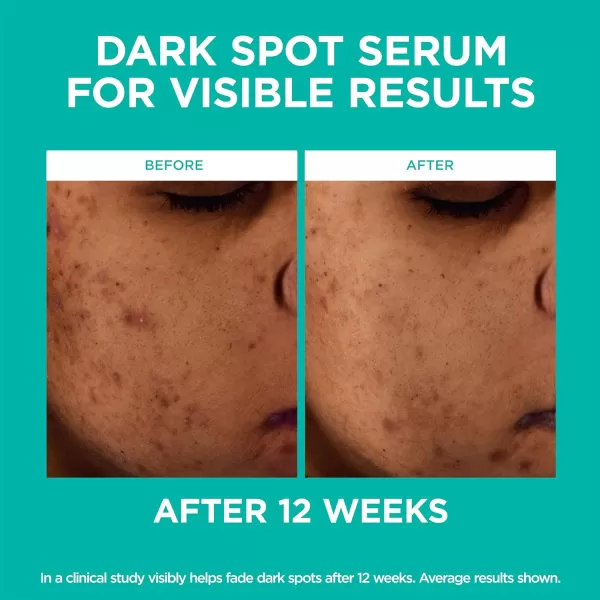 L’Oréal Paris Bright Reveal 12% [Niacinamide + Amino Sulfonic + Ferulic] Dark Spot Serum 1oz + Moisturizer Sample