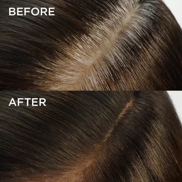 Root Rescue Light Blonde 9 2PK