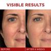 imageLOreal Paris Revitalift Triple Power AntiAging Face Moisturizer Pro Retinol Hyaluronic Acid ampamp Vitamin C Reduce Wrinkles 255 OzFragrance Free