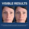 imageLOreal Paris Revitalift Pressed Night Cream Retinol  Niacinamide Reduces Wrinkles Fragrance Free 17 oz  Serum SampleUnscented