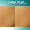 imageLOreal Paris Bright Reveal Dark Spot Exfoliant Peel 25 AHA BHA PHA Face Exfoliator Solution Gentle Skincare to Visibly Reduce Dark Spots and Renew Skin Texture Includes SPF Lotion Sample