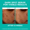 imageLOreal Paris Bright Reveal Niacinamide Dark Spot Serum  BroadSpectrum SPF 50 Daily UV Lotion  Moisturizer SamplesFace Serum  Daily SPF  Moisturizer Samples