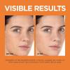 imageLOreal Paris Revitalift 12 Pure Vitamin C Serum Vitamin E Salicylic Acid Brightening 1 oz  Moisturizer SampleFragranced