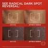 image:imageLOreal Paris Revitalift Triple Power Dark Spot Corrector CreamySerum Hyperpigmentation Treatment With Melasyl Vitamin C amp Niacinamide Treats Sun Spots Dark Spots Aging amp Uneven Tone 17 fl oz